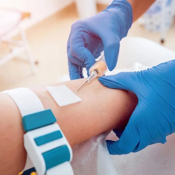 Kidney test analysis